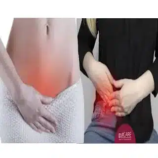 What’s Causing Pain in the Lower Left Abdomen – 6 Causes